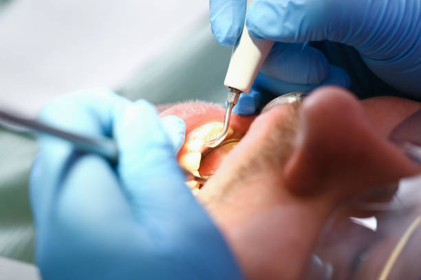 Best Emergency Treatment for Toothache in Alma, AR